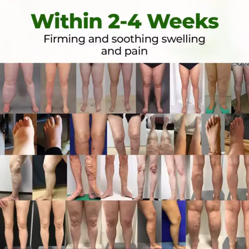 Professional Leg Circulation Cream - Image 2