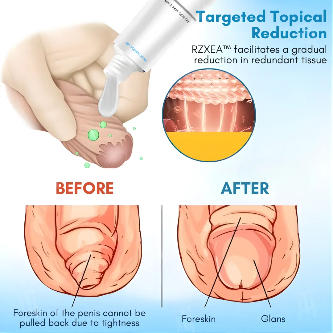 Foreskin Elasticity Gel - Image 4