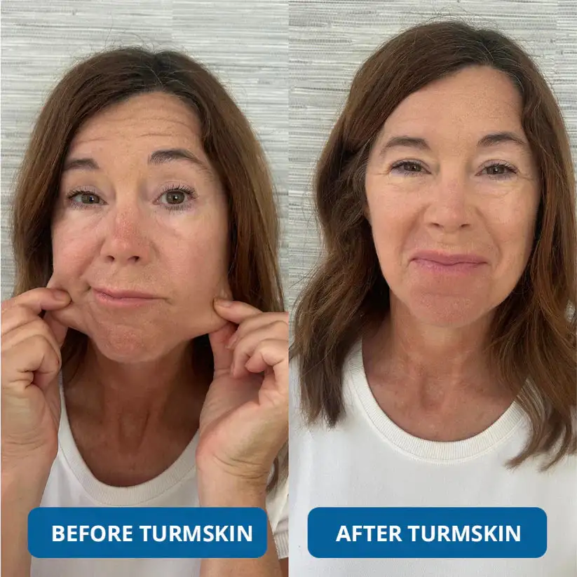 3% Hyaluronic Acid Ultra Hydrating Serum - Image 9