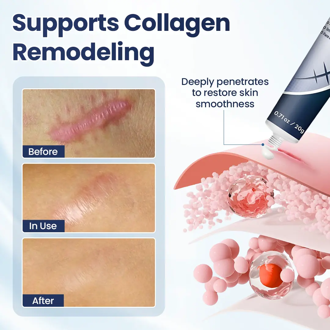 Texture Repair Gel - Image 8