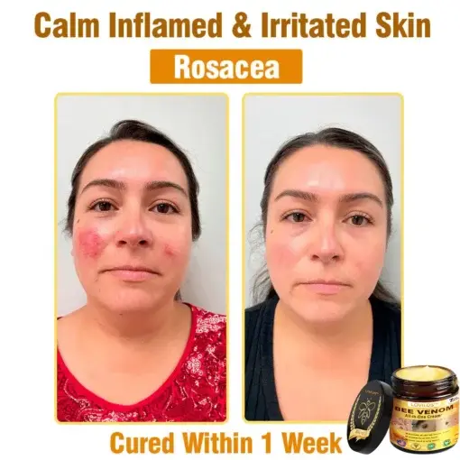 Bee Venom All-in-One Cream - Image 11