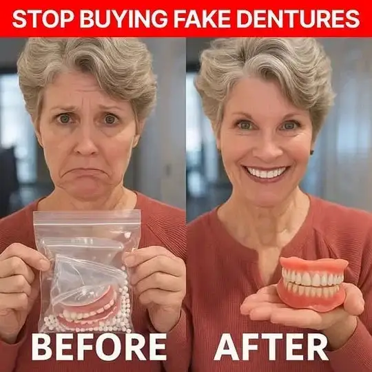 Custom-Fit Dentures - Image 10