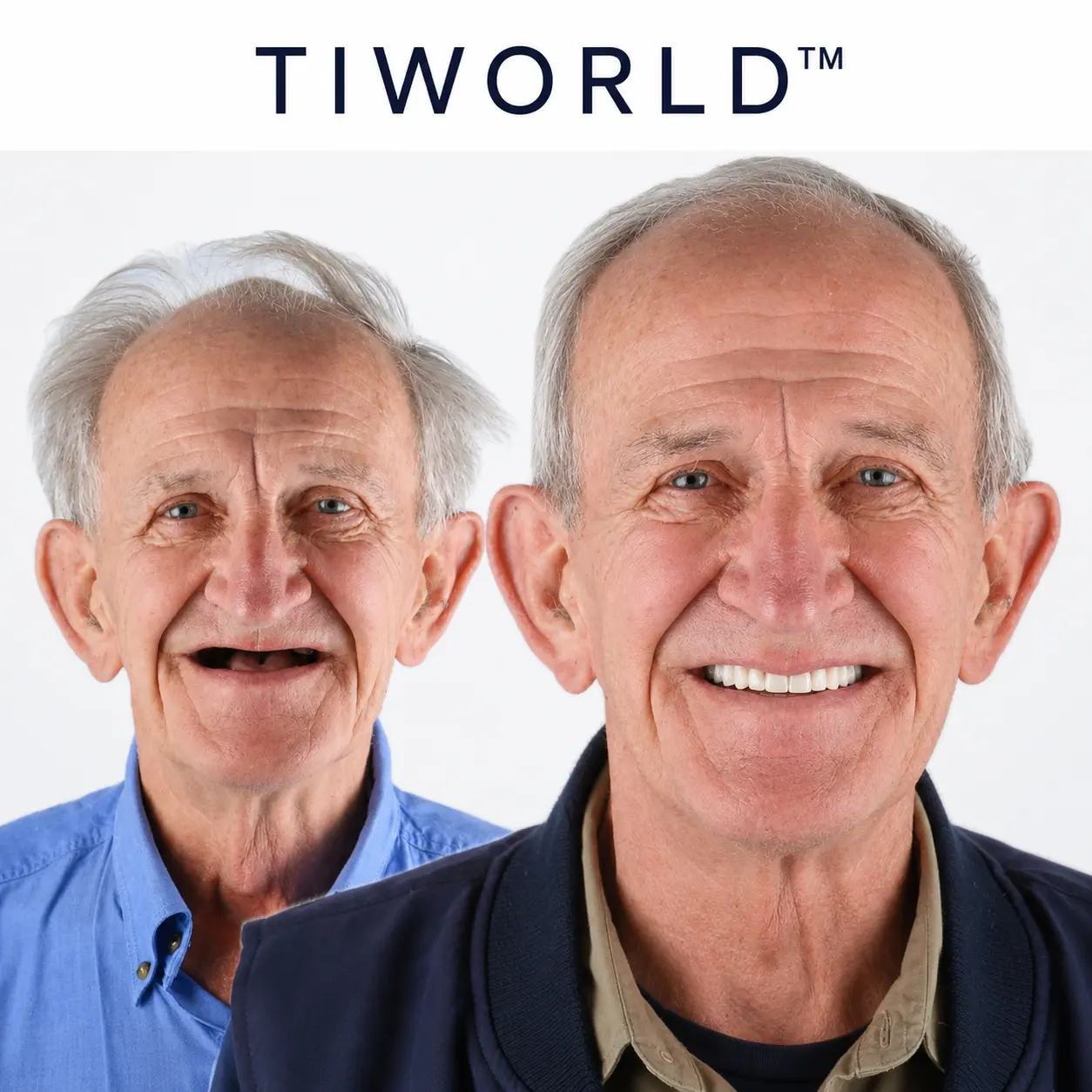 Custom-Fit Dentures - Image 9