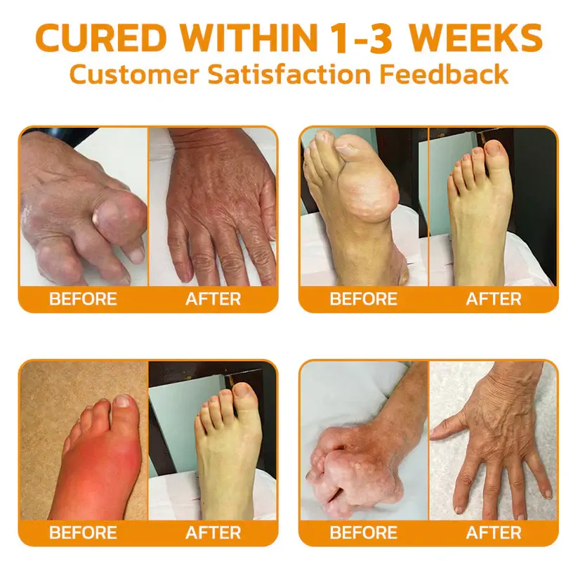 Lidocaine 5Mins Pain Relief Healing Spray - Image 2