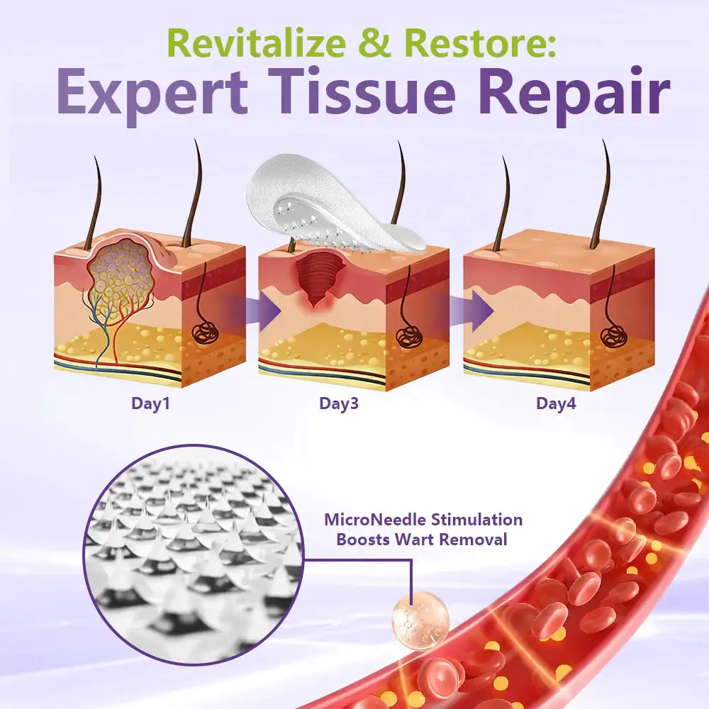 SOLUBLE MICRONEEDLE BOTANICAL SKIN TAG REMOVAL PATCH - Image 4