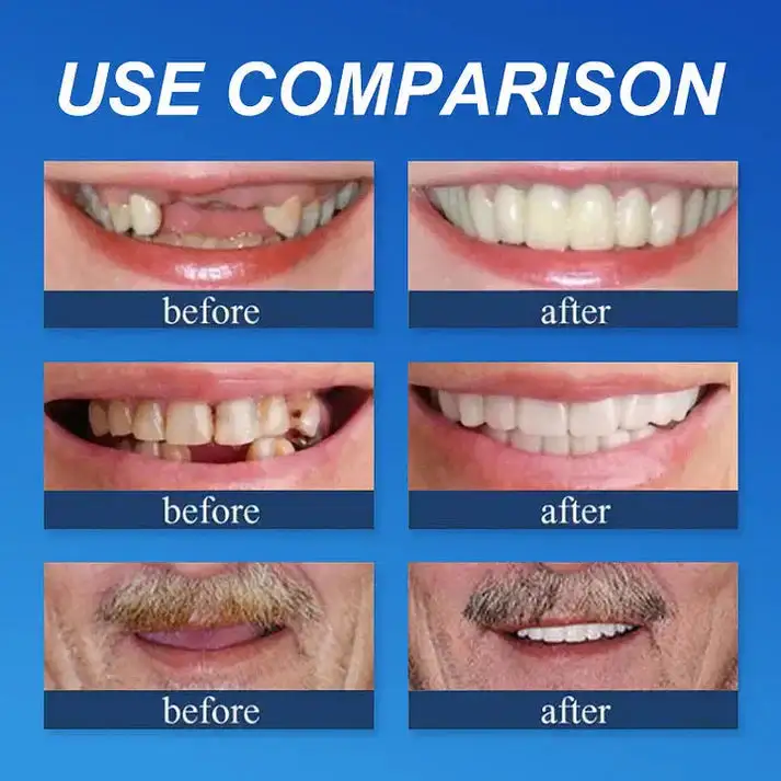 Natural Smile Upgrade - Image 6