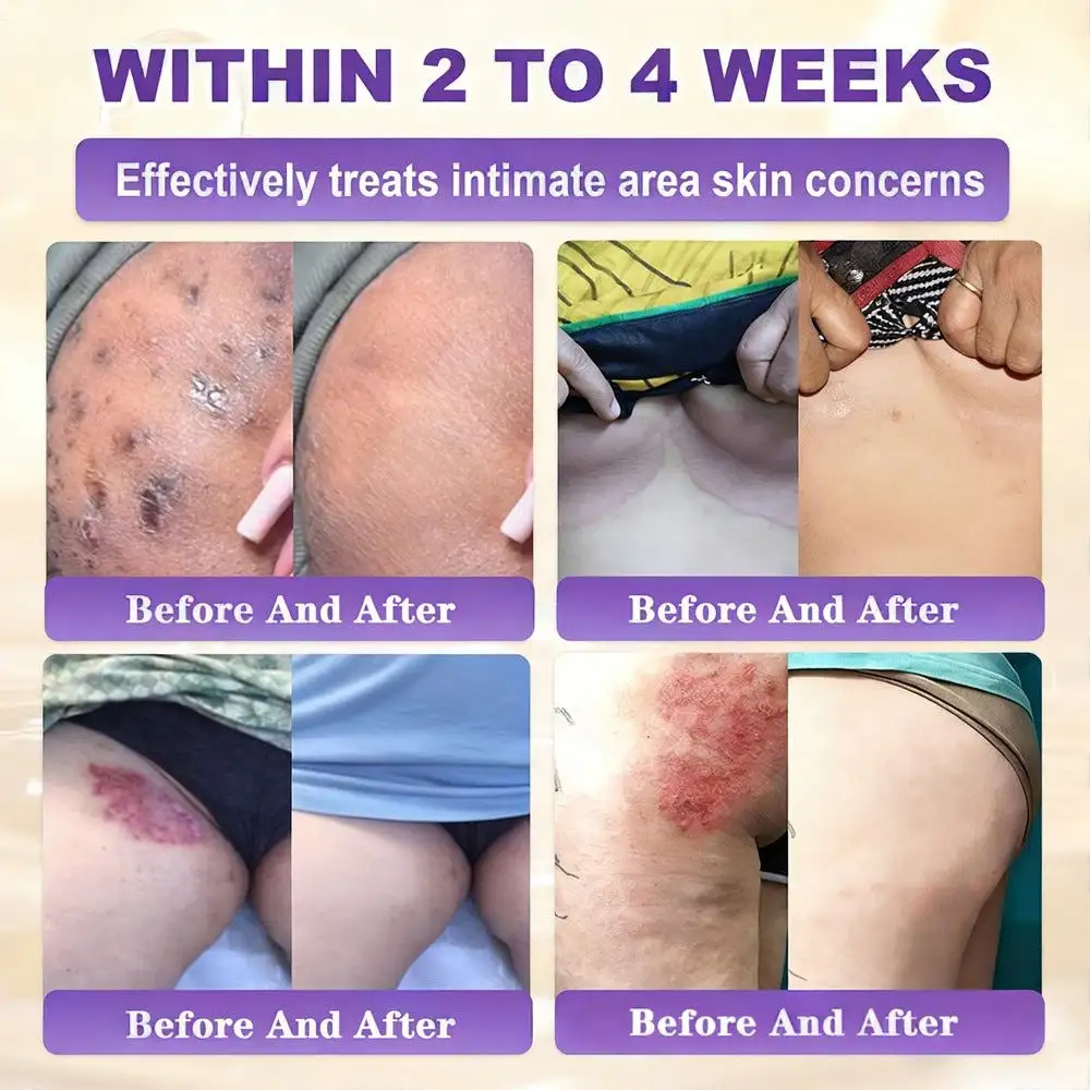 Biotin 10-in-1 Skin Repair Cream — Last Day of Sale: 75% Off - Image 4