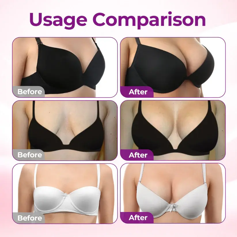 Targeted Breast Enhancement Advanced Nano Microneedle Patch - Image 4
