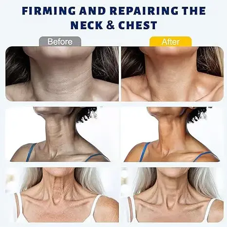 5-Roller Neck Firming Cream - Image 3