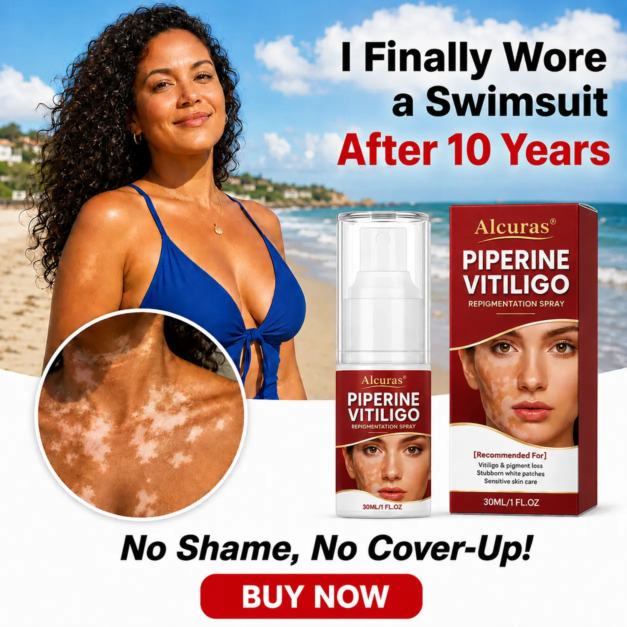 Advanced Piperine Vitiligo Repigmentation Spray - Image 9