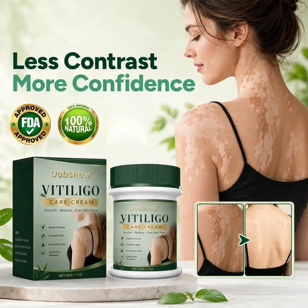Herbal Vitiligo Cream