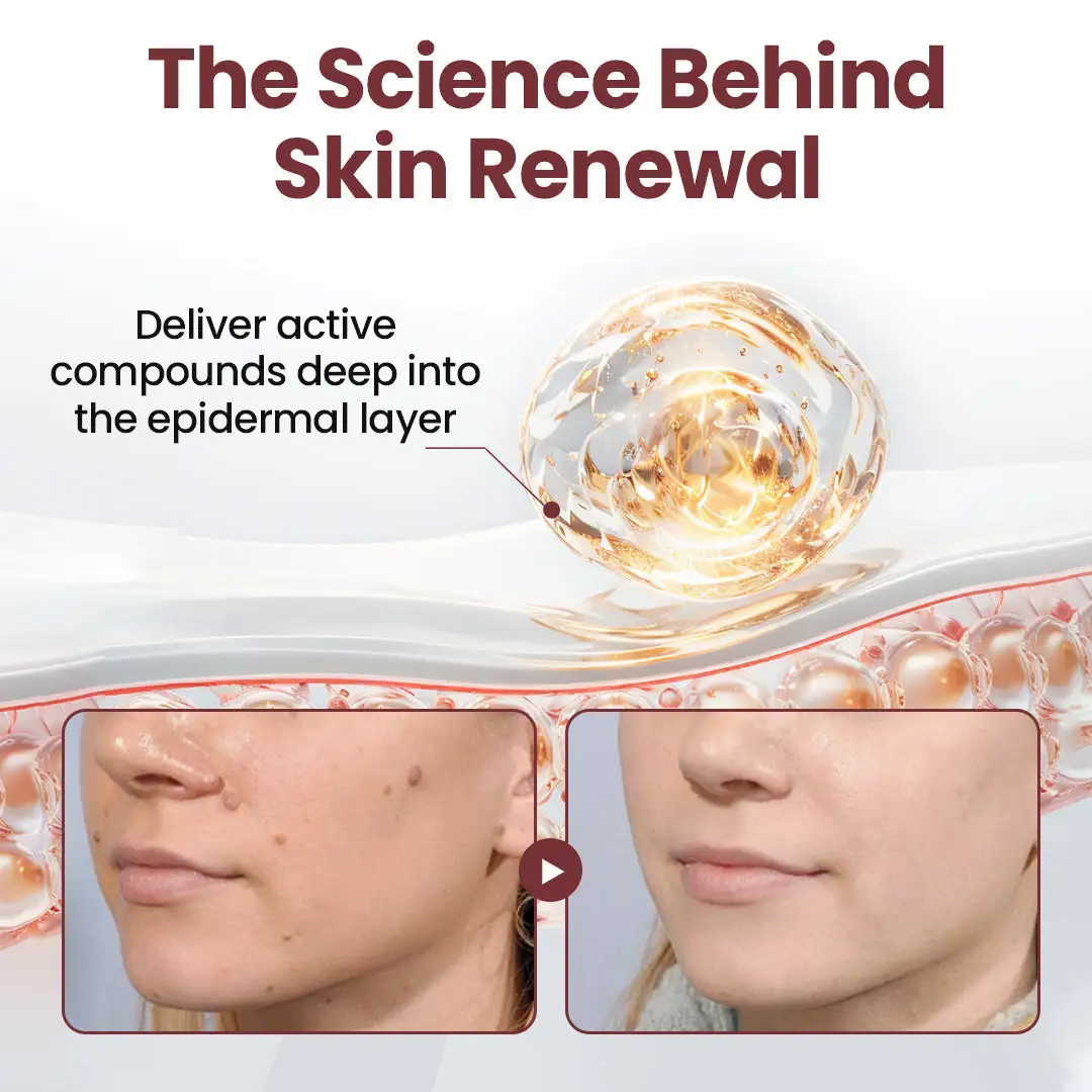 KeraErase Dual-Action Renewal Cream - Image 3