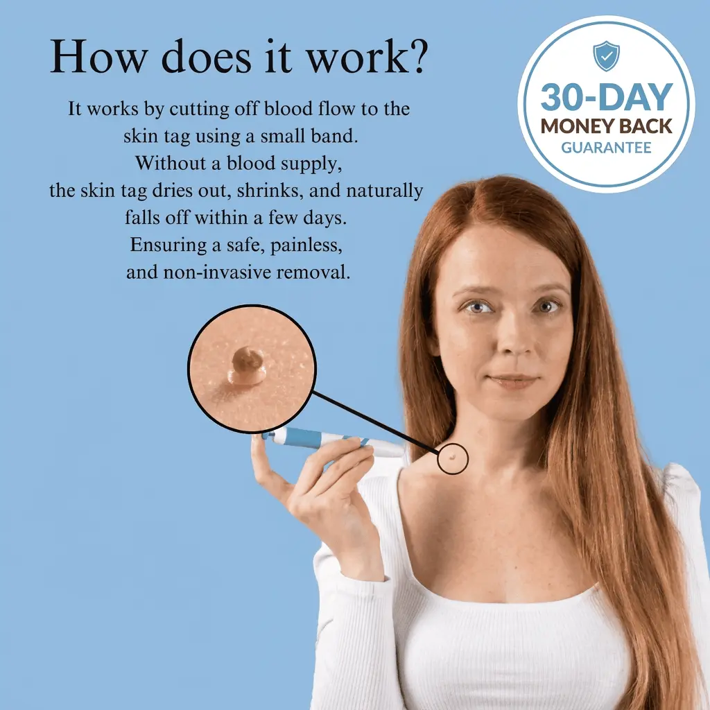 Painless Skin Tag Removal Kit - Image 4