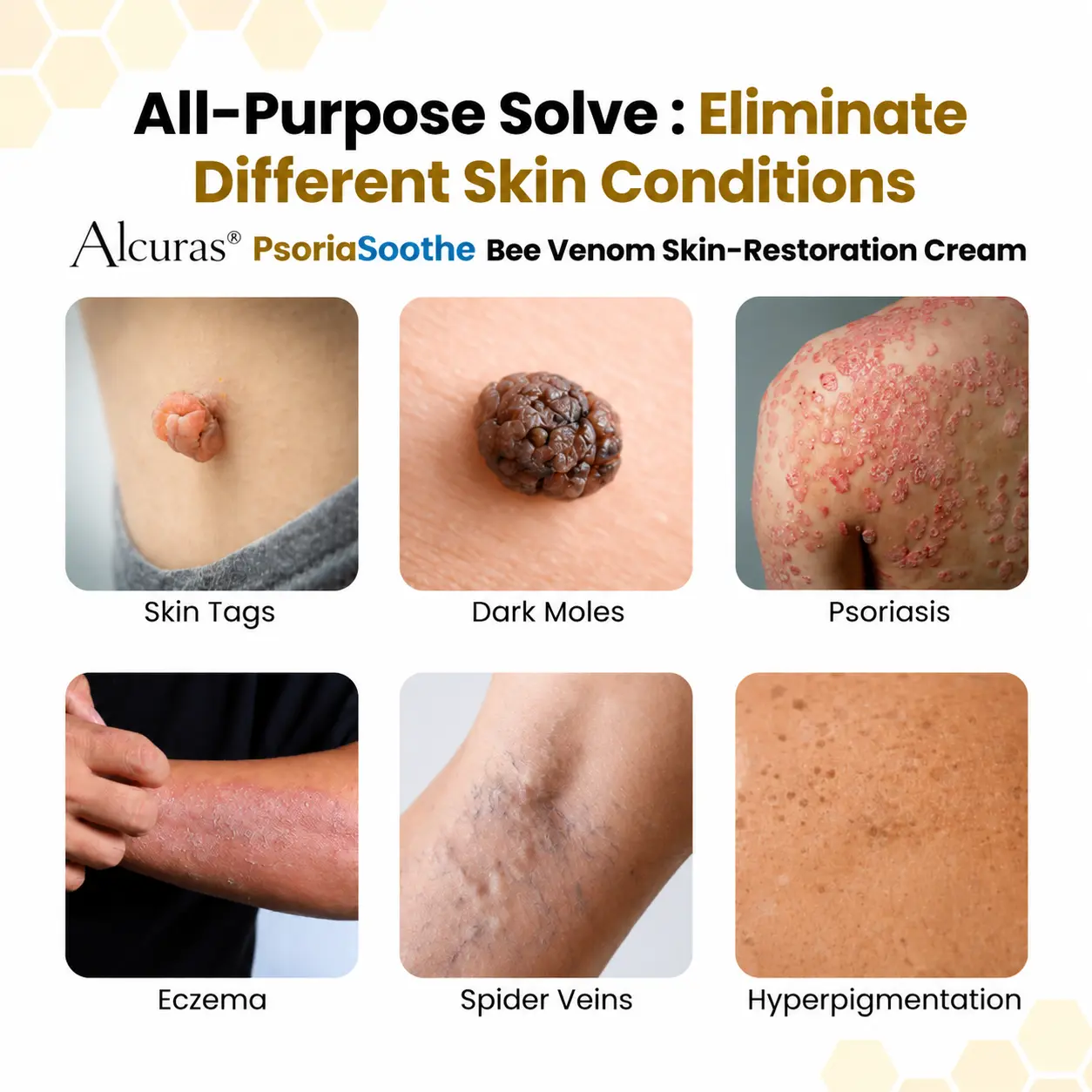 PsoriaSoothe Bee Venom Skin-Restoration Cream - Image 3