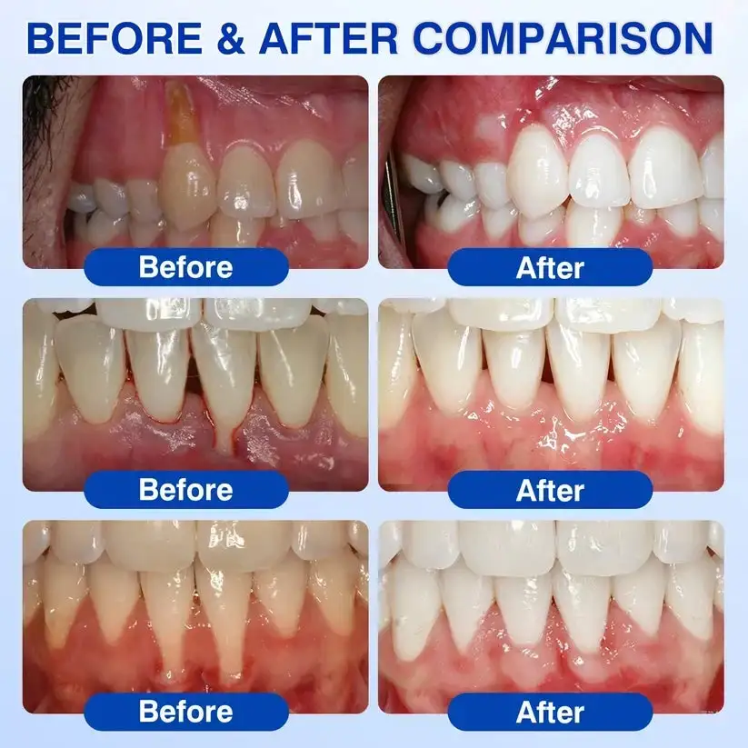 GumRevive Periodontal Repair Gel - Image 6