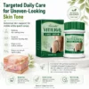 Herbal Vitiligo Cream