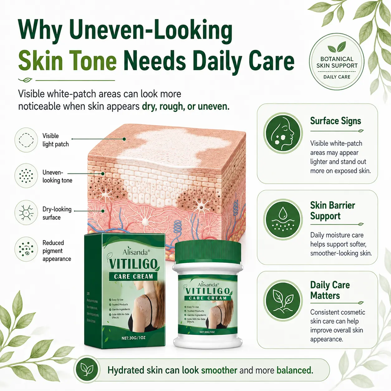 Herbal Vitiligo Cream - Image 2