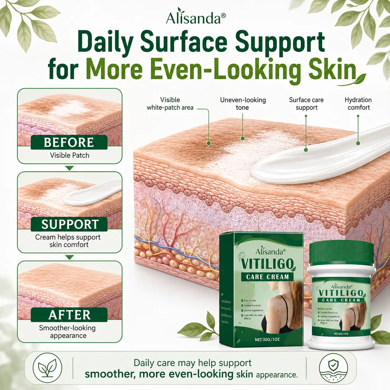 Herbal Vitiligo Cream - Image 3