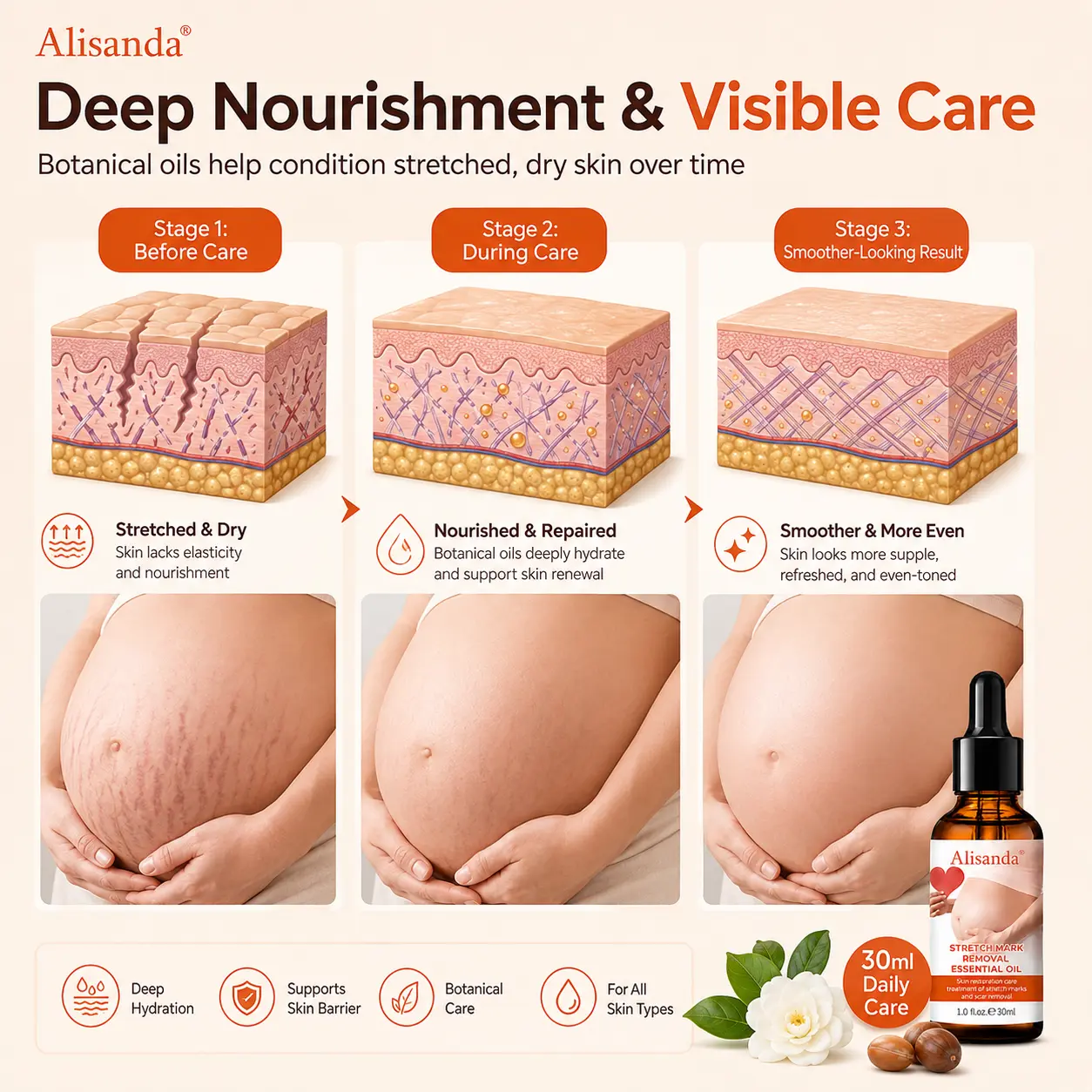 SilkStretch Natural Stretch Mark & Scar Oil - Image 3