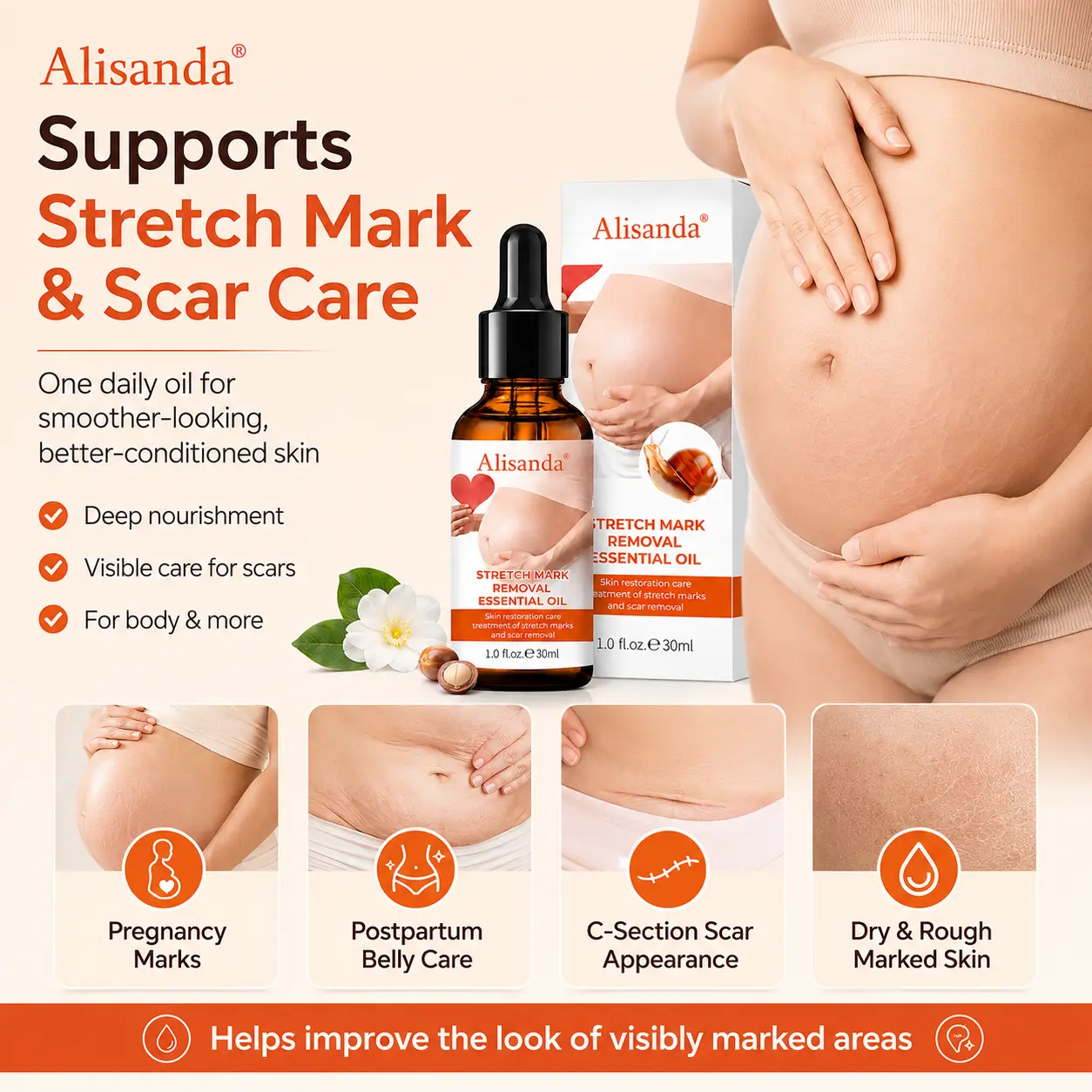 SilkStretch Natural Stretch Mark & Scar Oil - Image 6
