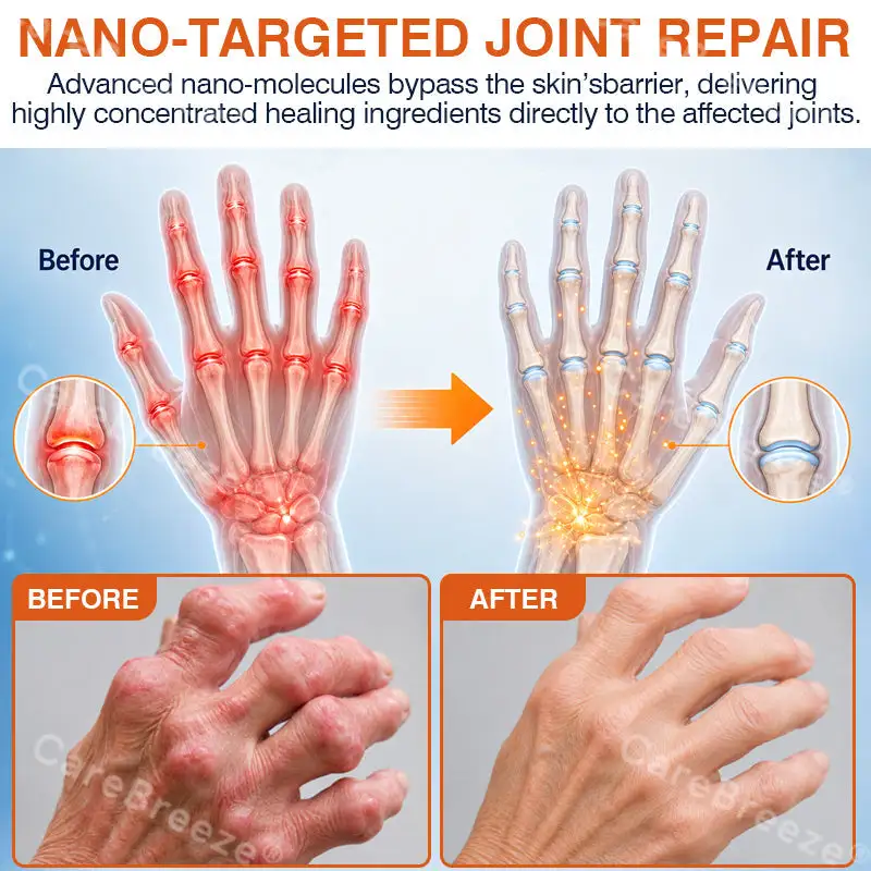 Pain-Relief Bone-Healing Microneedle Patch - Image 7