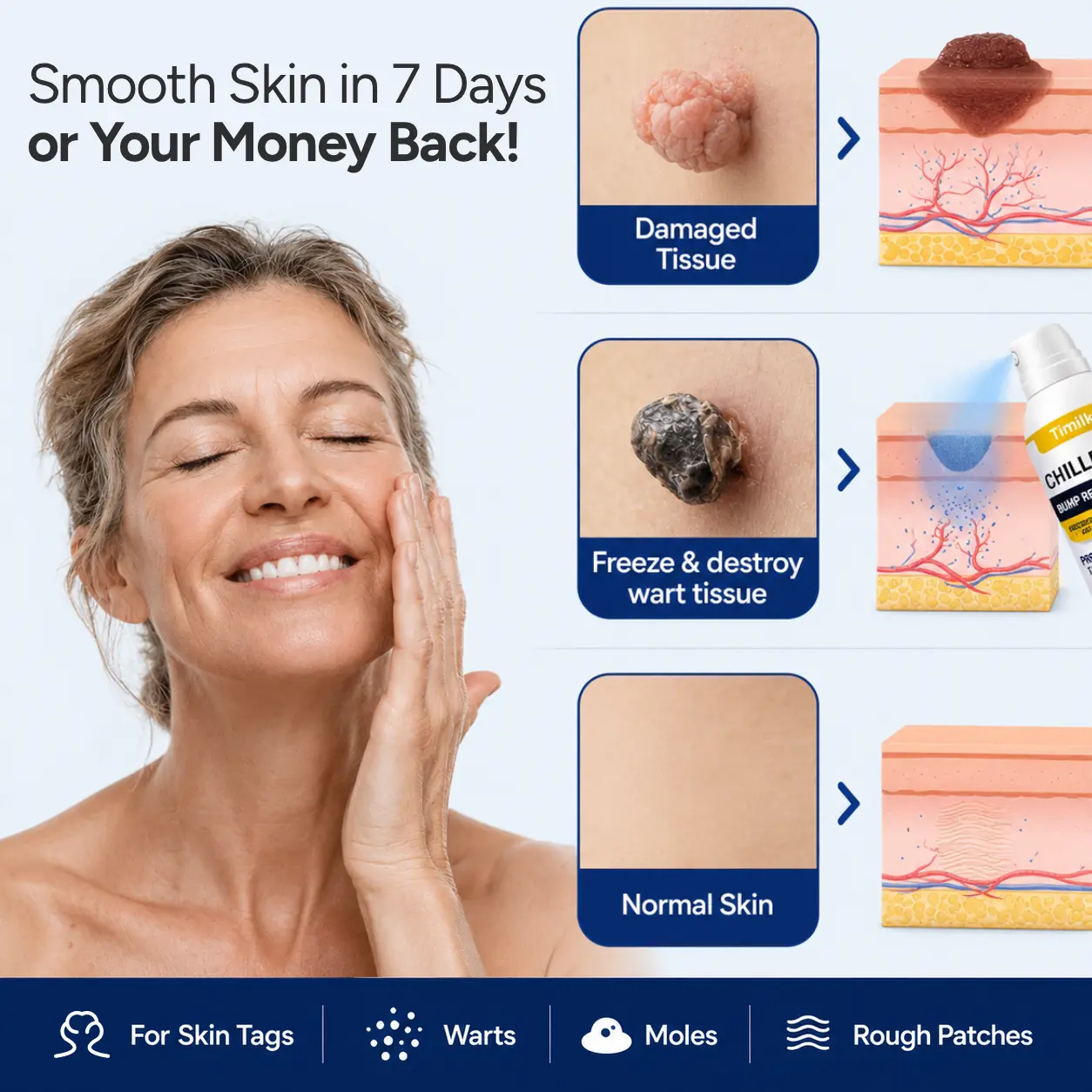 ChillErase Precision Skin Tag & Wart Removal Spray - Image 6