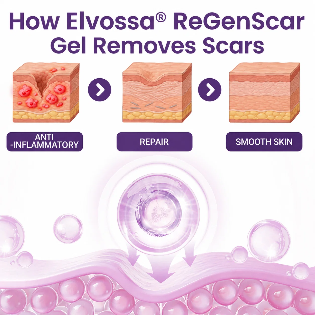 ReGenScar Stem Cell Scar Gel - Image 3