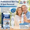 Advanced Wart Removal Pen