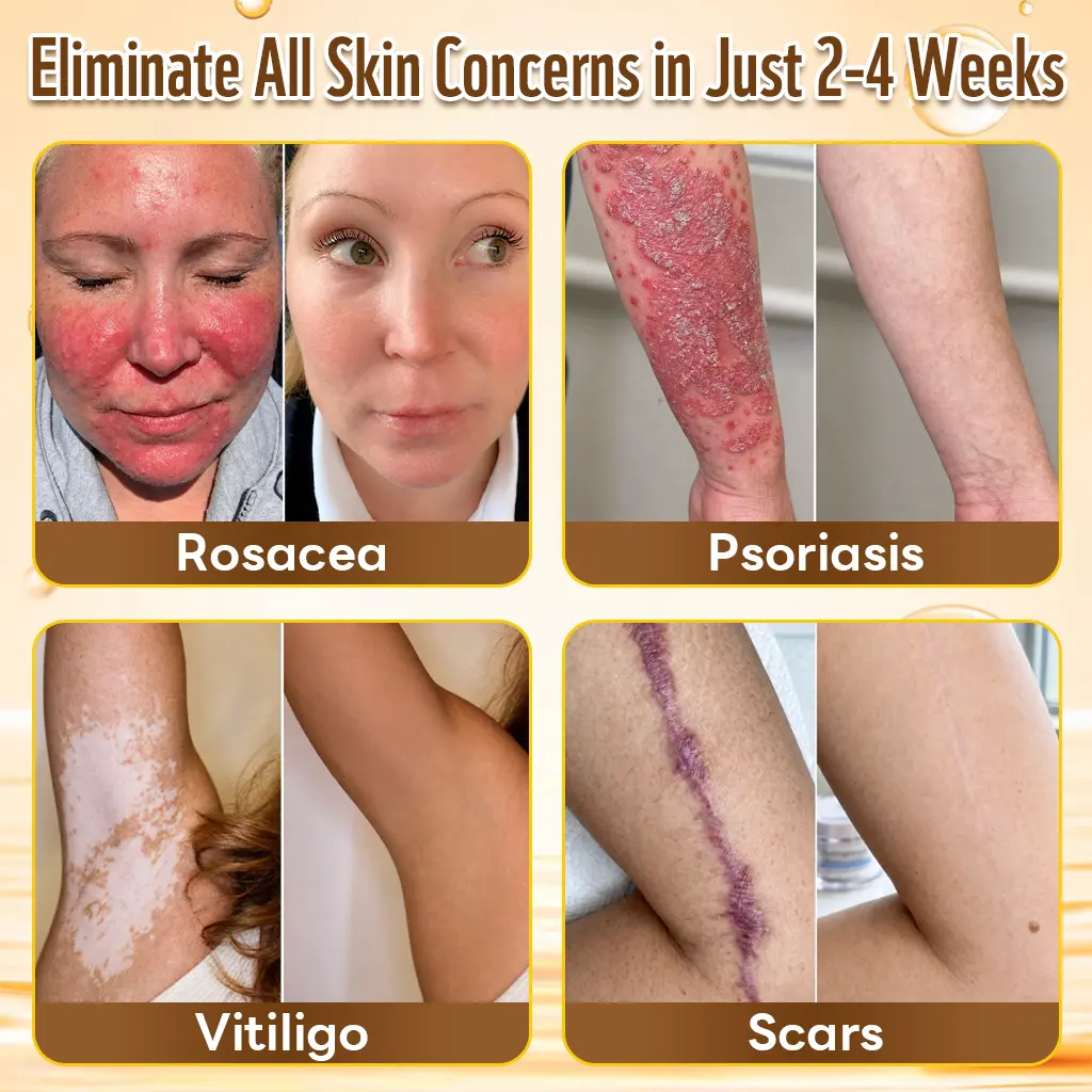 Multi-Concern Skin Repair Cream - Image 4