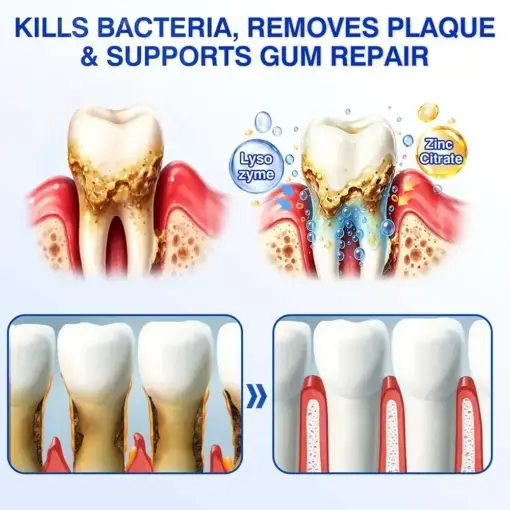 GumRevive gel - Image 10