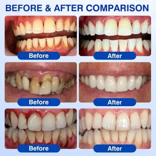 GumRevive gel - Image 9