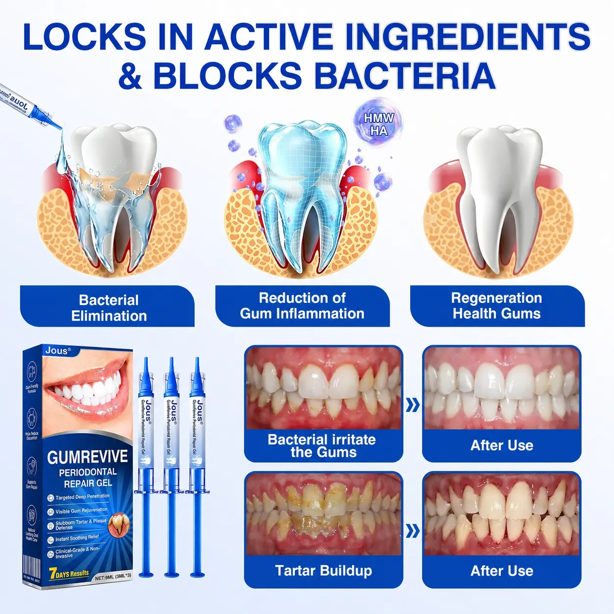 GumRevive Periodontal Repair Gel - Image 8
