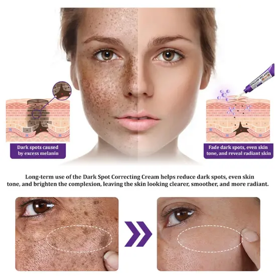 Lovilds Epiglow Melanev Advanced Anti Pigmentation Cream - Image 3