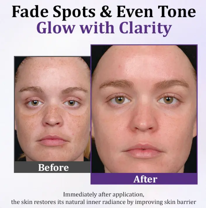 Lovilds Epiglow Melanev Advanced Anti Pigmentation Cream - Image 4