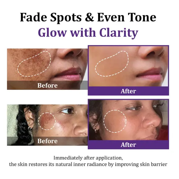 Lovilds Epiglow Melanev Advanced Anti Pigmentation Cream - Image 6