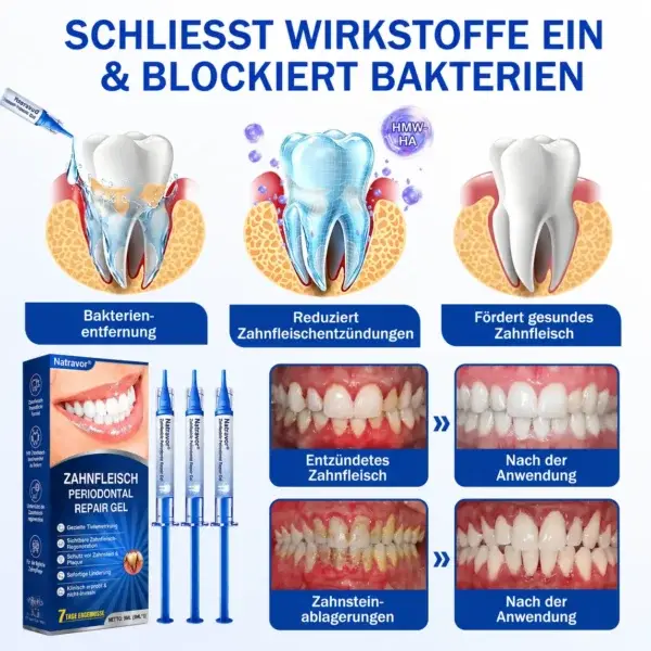 GumCare Pro | Zahnfleischpflege & Parodontal Gel - Image 2