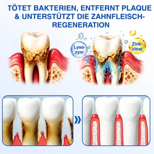 GumCare Pro | Zahnfleischpflege & Parodontal Gel - Image 6