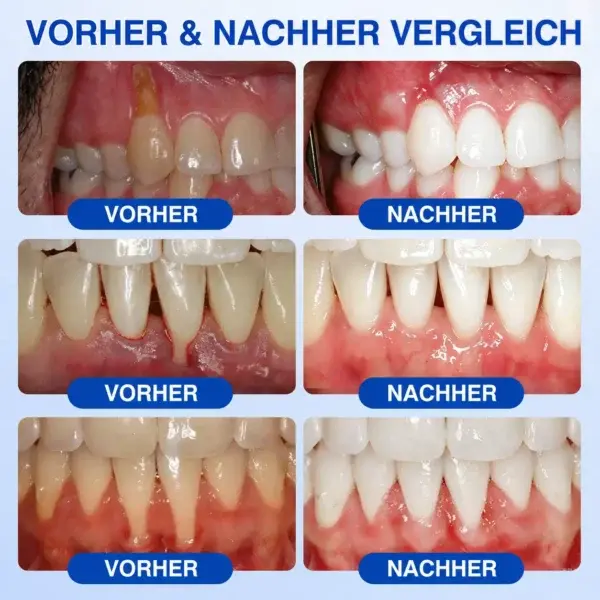 GumCare Pro | Zahnfleischpflege & Parodontal Gel - Image 8