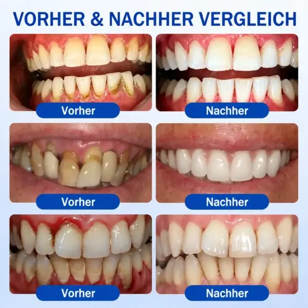 GumCare Pro | Zahnfleischpflege & Parodontal Gel - Image 9