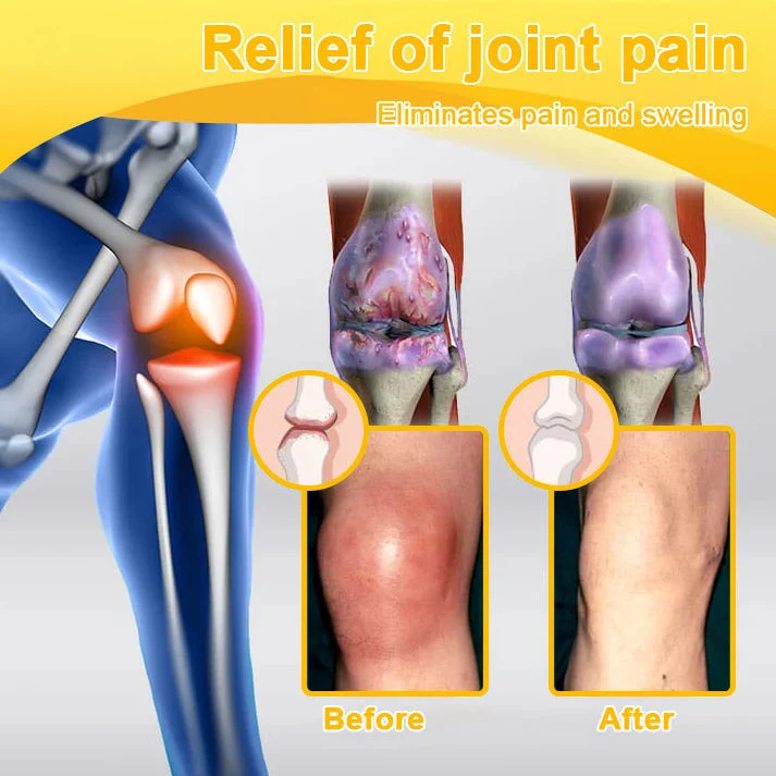 Botulinum Toxin & Bee Venom Joint Pain Relief - Image 3