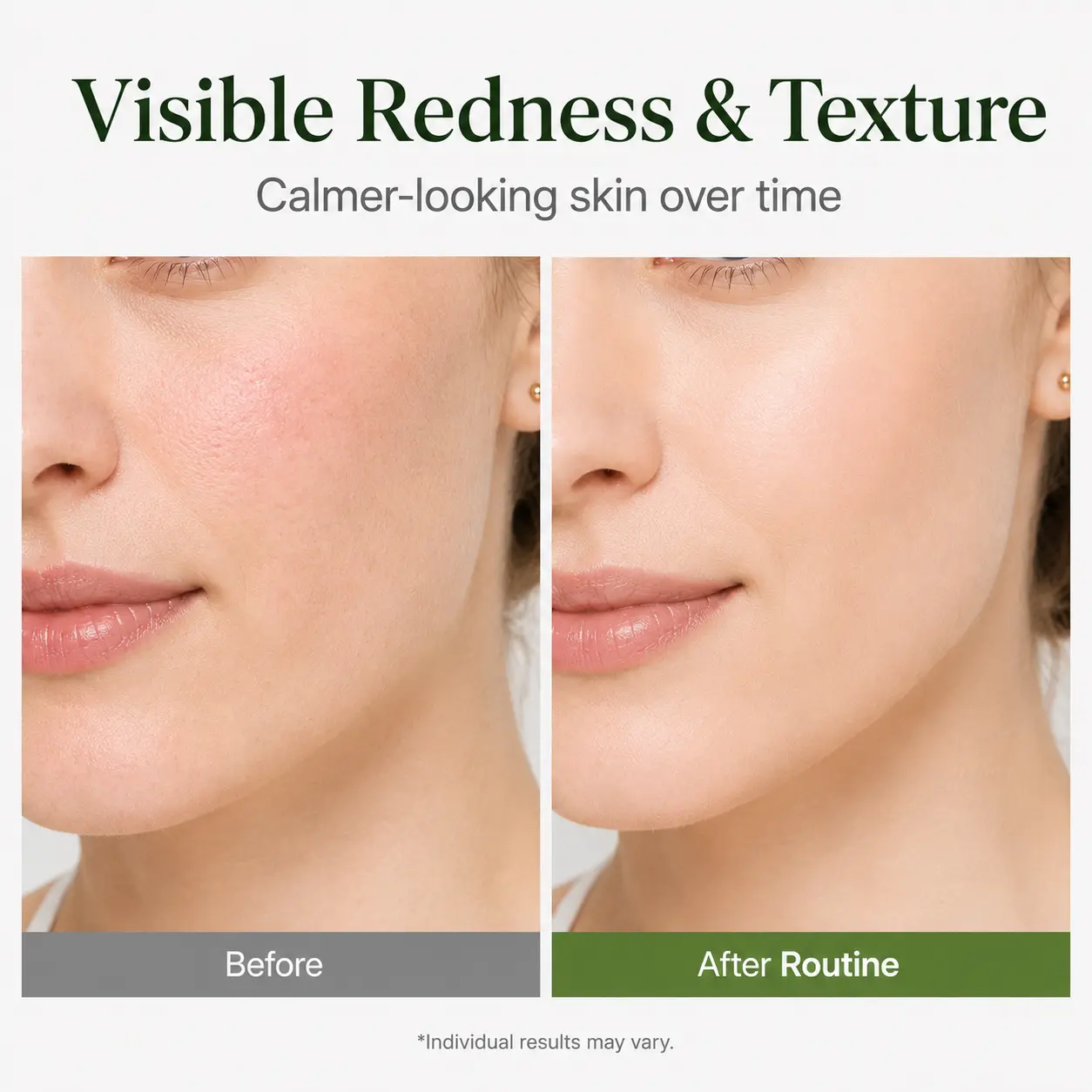 NESLEMY 10% Azelaic Acid + Hyaluron Soothing Serum - Image 4