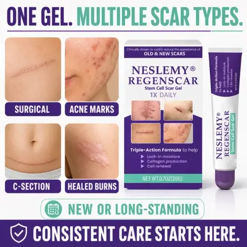 ReGenScar Stem Cell Scar Gel - Image 10