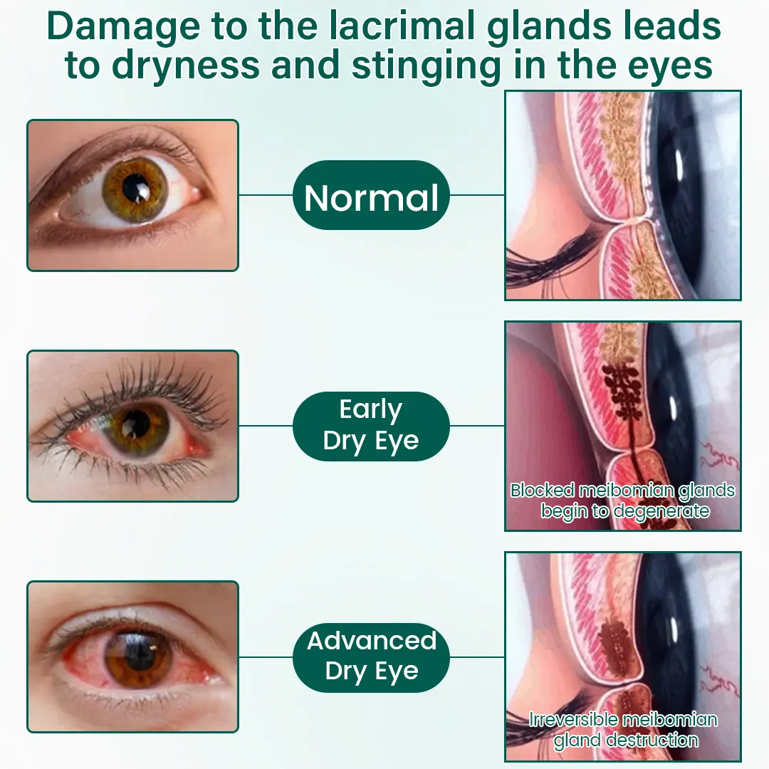 OptiClear Nano Eye Roller Serum - Image 10