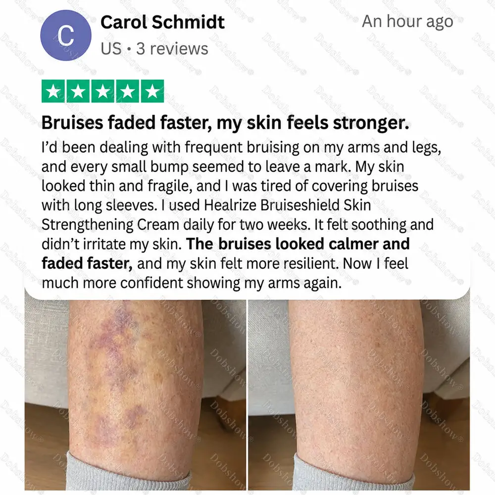 BRUISESHIELD Skin Strengthening Cream - Image 3