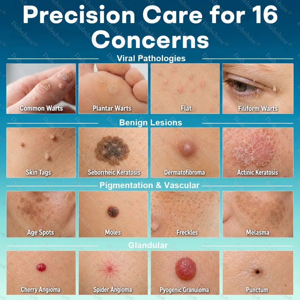 Precision Wart & Blemish Care Roll-On Pen - Image 2
