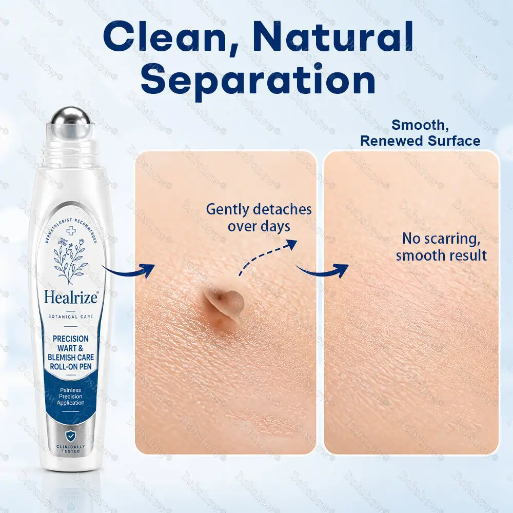 Precision Wart & Blemish Care Roll-On Pen - Image 6