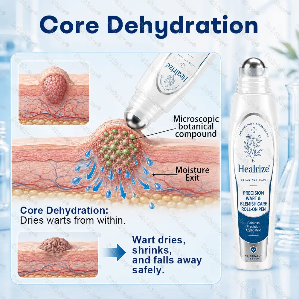 Precision Wart & Blemish Care Roll-On Pen - Image 7