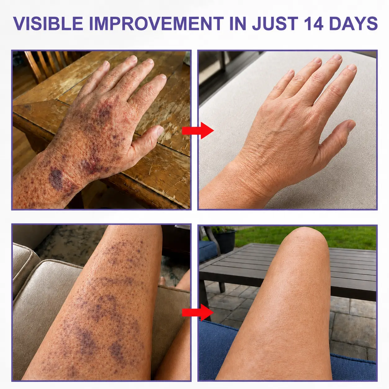 All-New Upgraded Dark Spot Correcting - Bruise Healing & Skin Strengthening Cream - Image 2