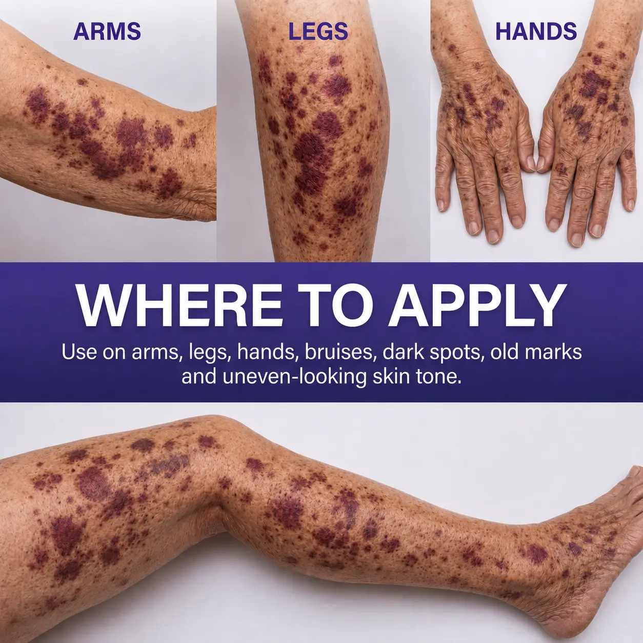 All-New Upgraded Dark Spot Correcting - Bruise Healing & Skin Strengthening Cream - Image 6