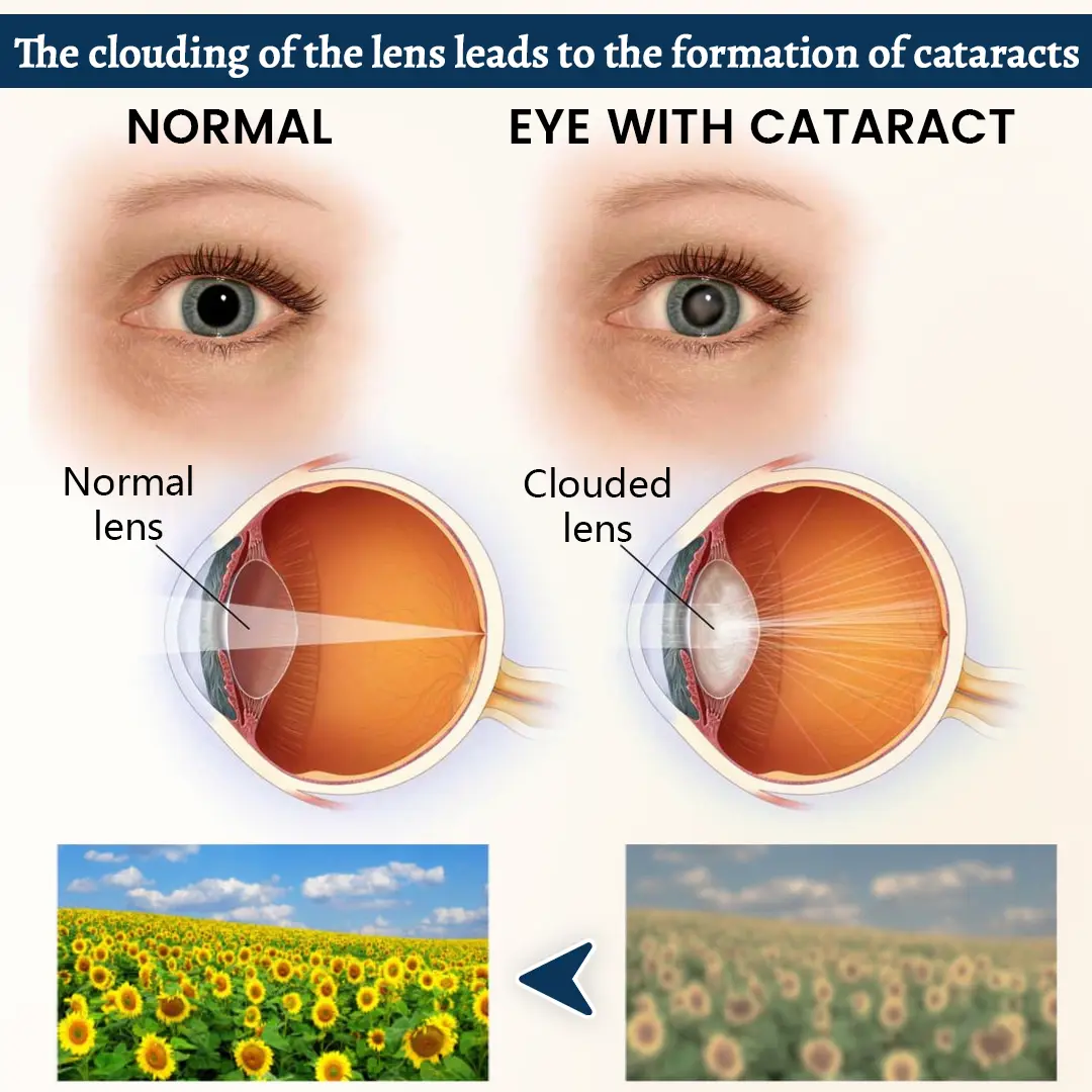 VisionFusion Support Eye Patch - Image 3